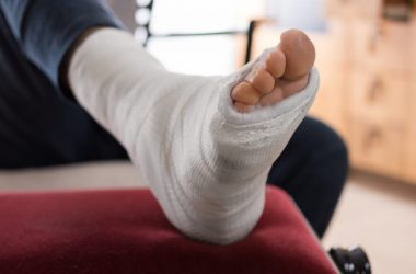 Damages in Personal Injury Claim