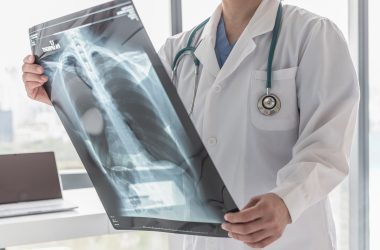 Failure to Properly Read X-Rays