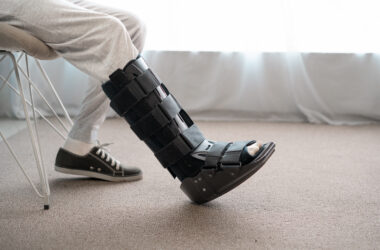 Can a Broken Bone Be a Catastrophic Injury in Personal Injury Cases?